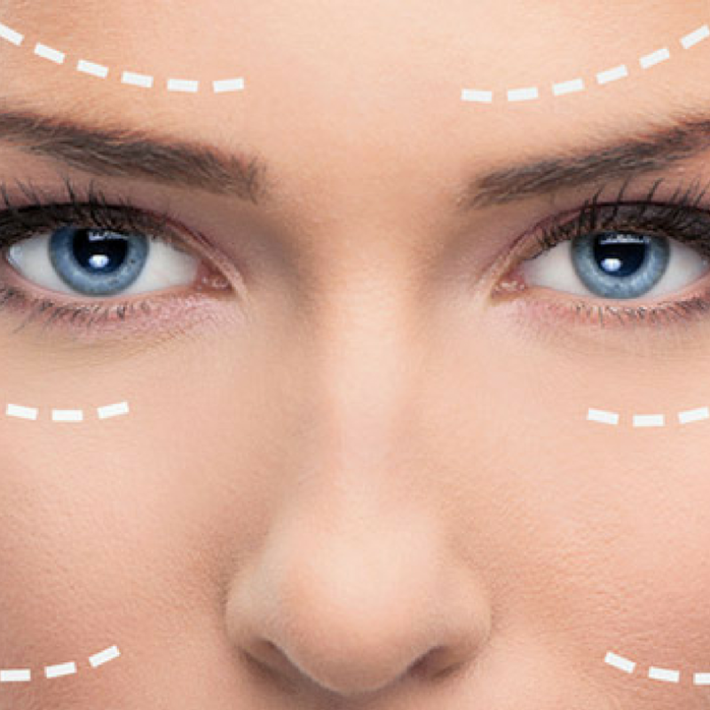 ΣΥΣΦΙΞΗ ΕΠΙΔΕΡΜΙΔΑΣ